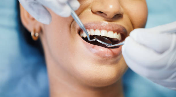 Best Emergency Denture Repair in St Marys, OH