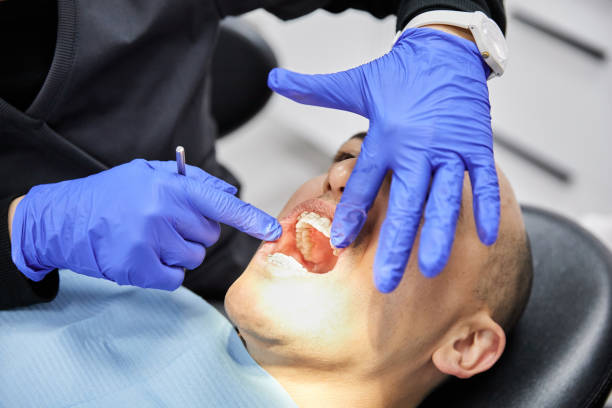 Best Broken or Chipped Tooth Repair in St Marys, OH