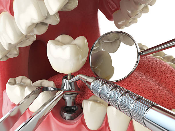 Best Walk-In Emergency Dental Services in St Marys, OH